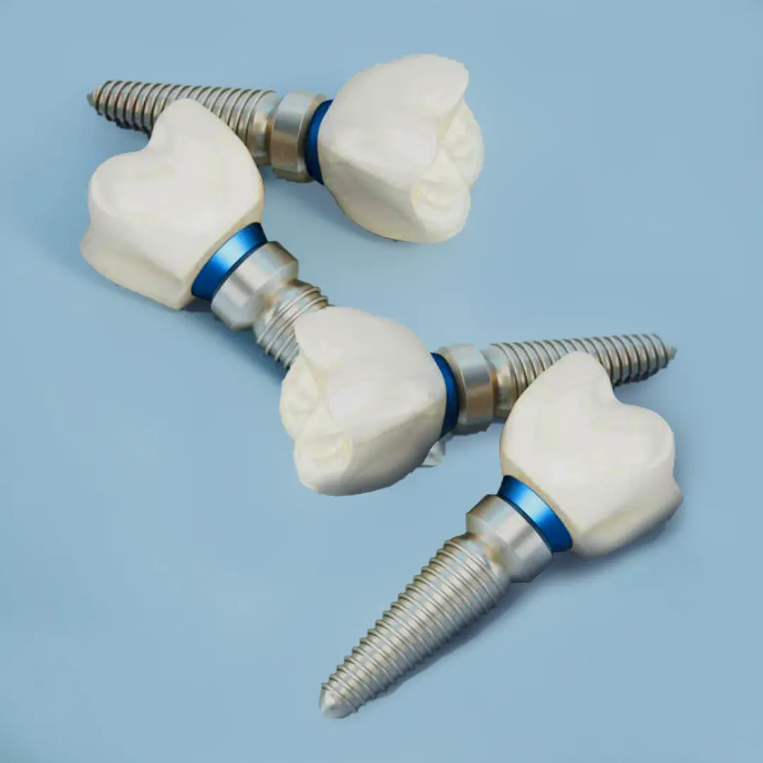 Piezas de implantes dental