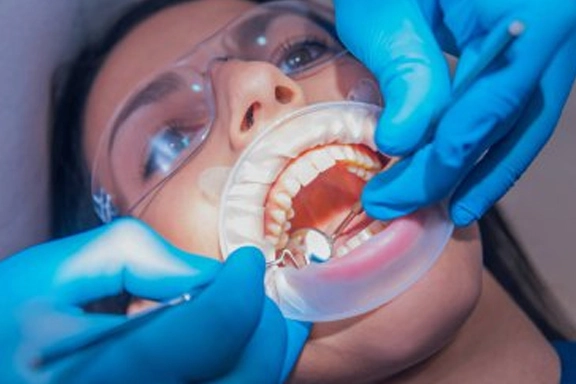 Procedimiento dental de endodoncia