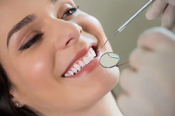 Blanqueamiento Dental Profesional